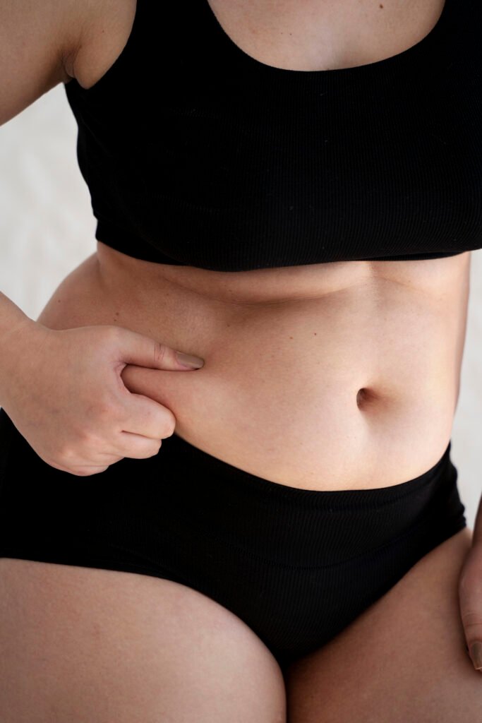 Body contour liposuction