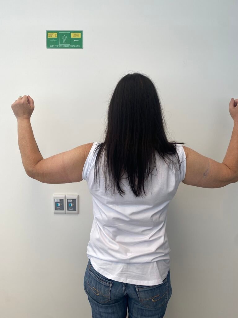 arm lift A9