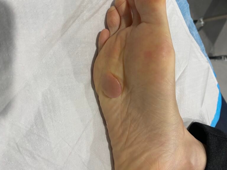 growth foot